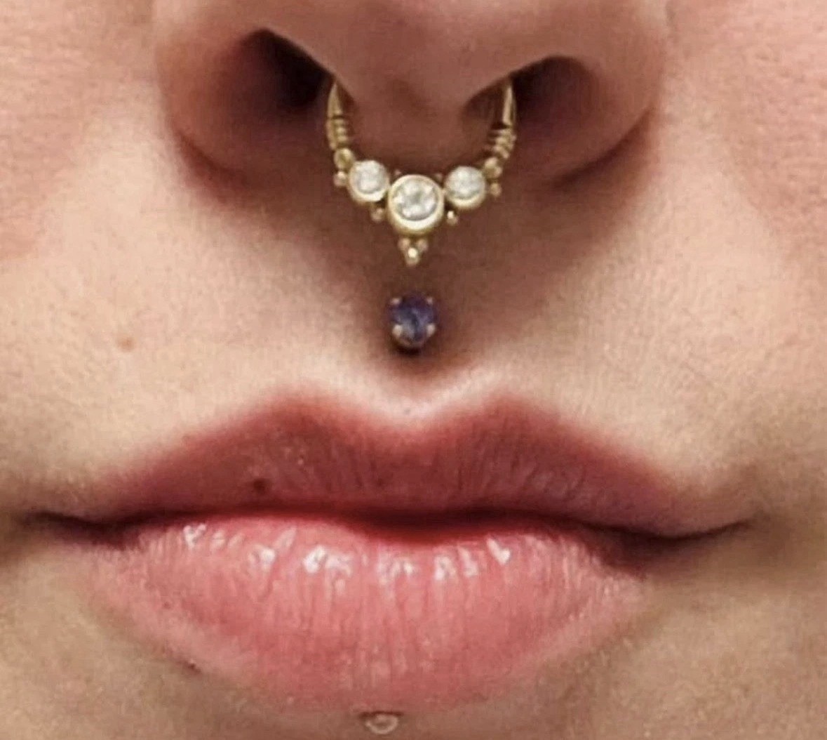 bvla bundle - image 3