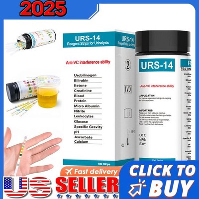 URS-14 100strips Urinalysis Reagent Test Paper Parameters Test Strips Leukocytes