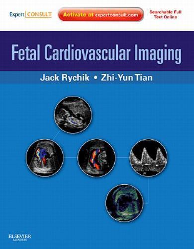 Fetal Cardiovascular Imaging: A Disease Based Approach Rychik Tian Hardback