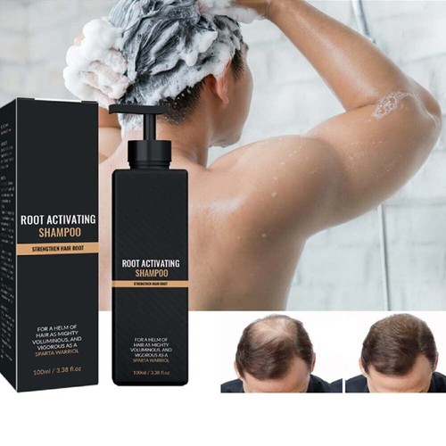 5X Shampoo Spartano, Shampoo Attivatore Radice di Spartano, Shampoo Ricremento Capelli Naturali - Foto 3 di 17