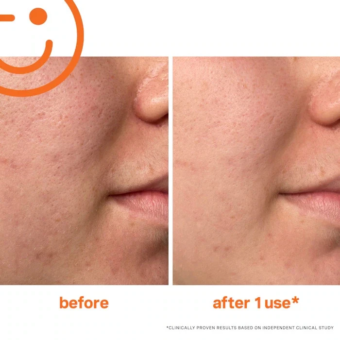 NEW Kate Somerville ExfoliKate Intensive Exfoliating Treatment 2FL/100%AUTHENTIC - Image 2 of 4