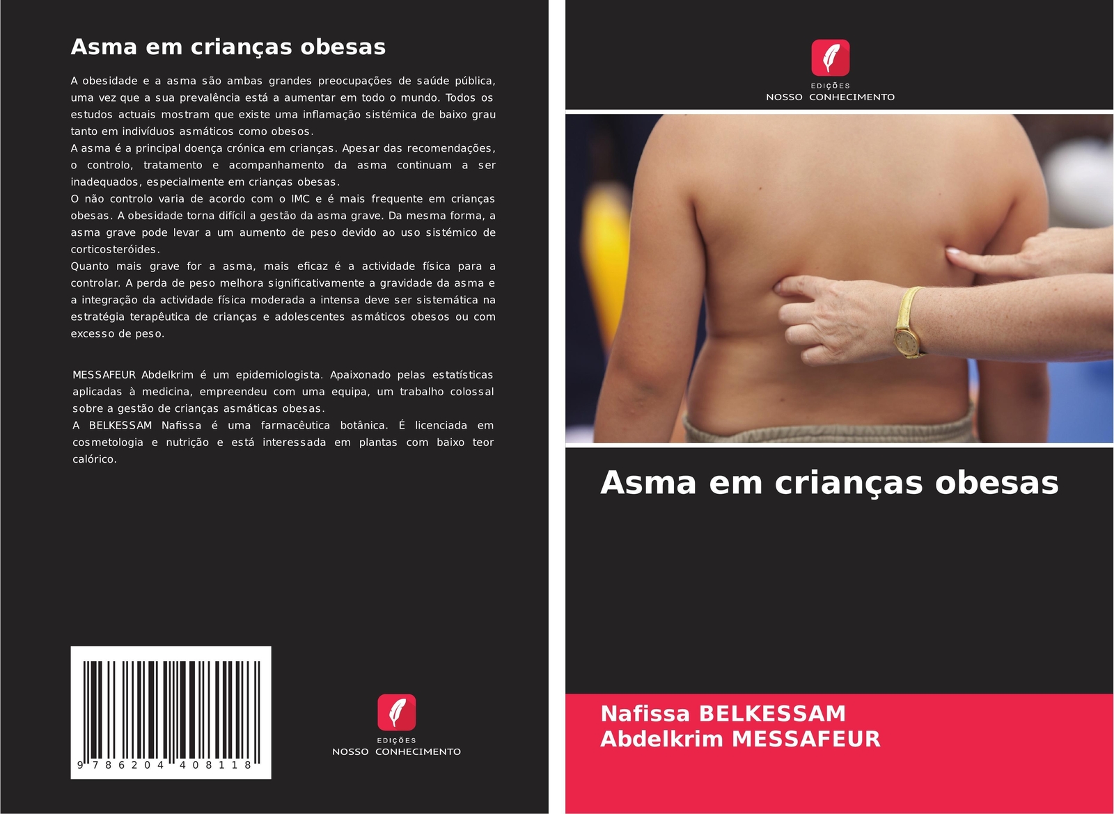 Thumbnail - Nafissa Belkessam (u. A.) | Asma Em Crianças Obesas | Taschenbuch