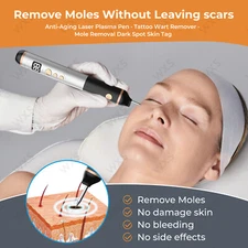 Skin Removal Kit，15-level Physically Remove Moles，PLASMA PEN，Spot removal pen