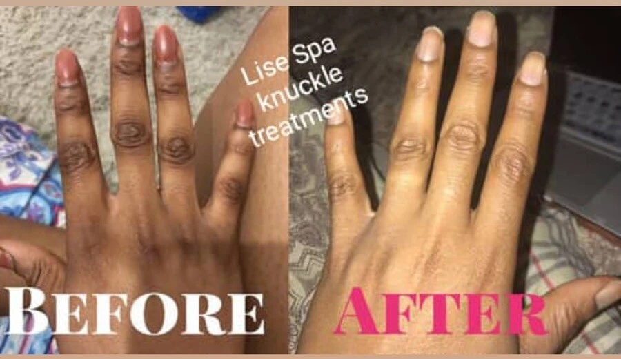 BORRADOR DE NUDILLOS OSCUROS/PIES/LOCIÓN DE CODO DE ACCIÓN RÁPIDA TONO UNIFORME CLARO, 7 días 6 oz👌 Foto 4 de 4