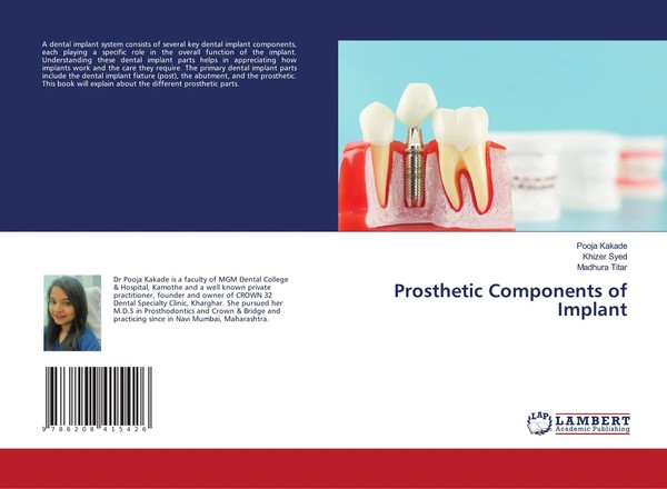 Pooja Kakade (U. A.) | Prosthetic Components Of Implant | Taschenbuch | Englisch-image