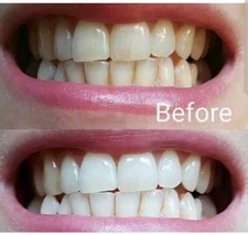 Toothpaste Whitening Fluoride  