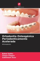 Rahul Sathu (U. A.) | Ortodontia OsteogéNica Periodonticamente Acelerada | Buch