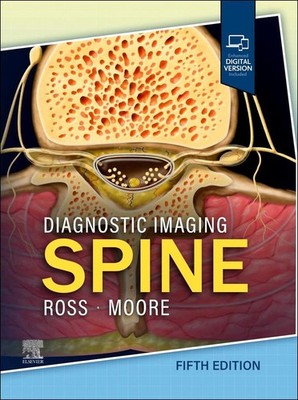 Diagnostic Imaging: Spine | Jeffrey S. Ross, Kevin R. Moore | englisch