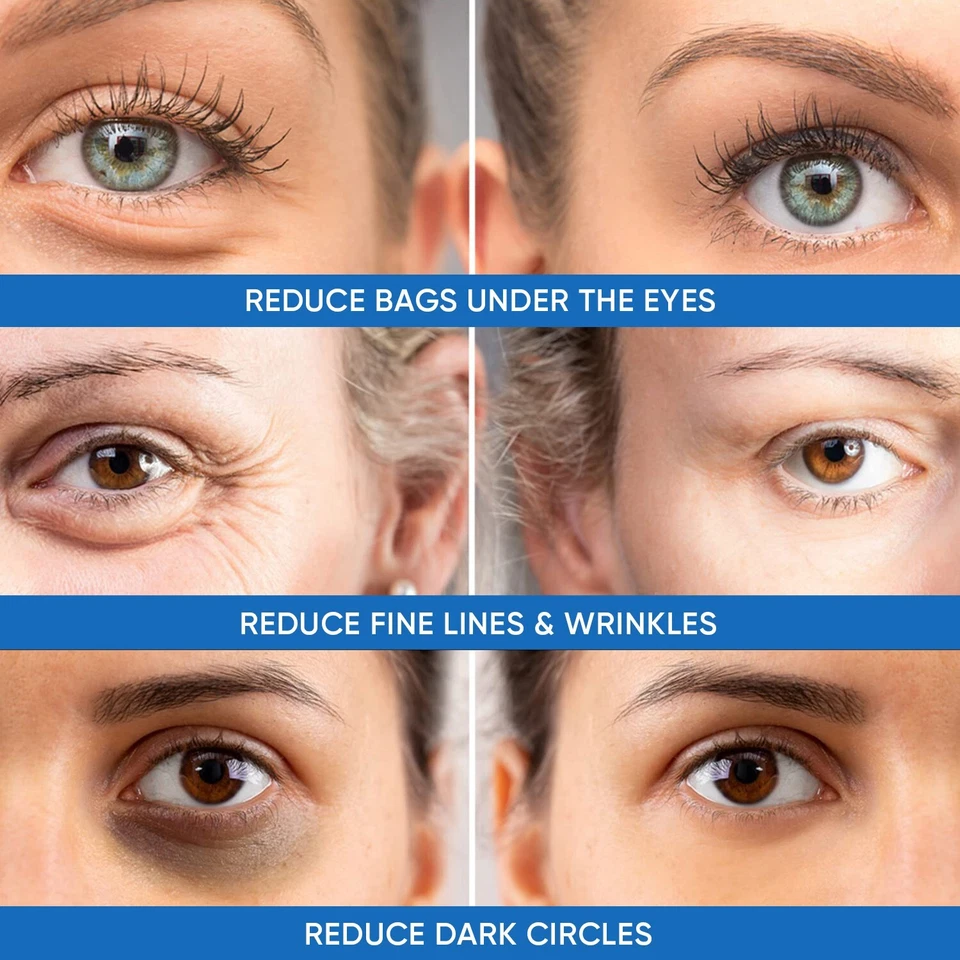 Under Eye Puffiness & Dark Circles Rapid Treatment- Instantly Reduces Puffy Eye - Image 3 of 4