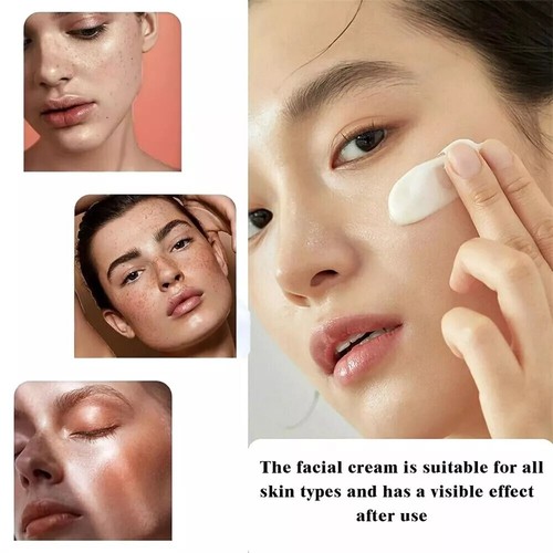 Spot Fading Urea Cream,2025 New Vitamin E Urea Cream,2.47Fl.oz/70g - Picture 23 of 24