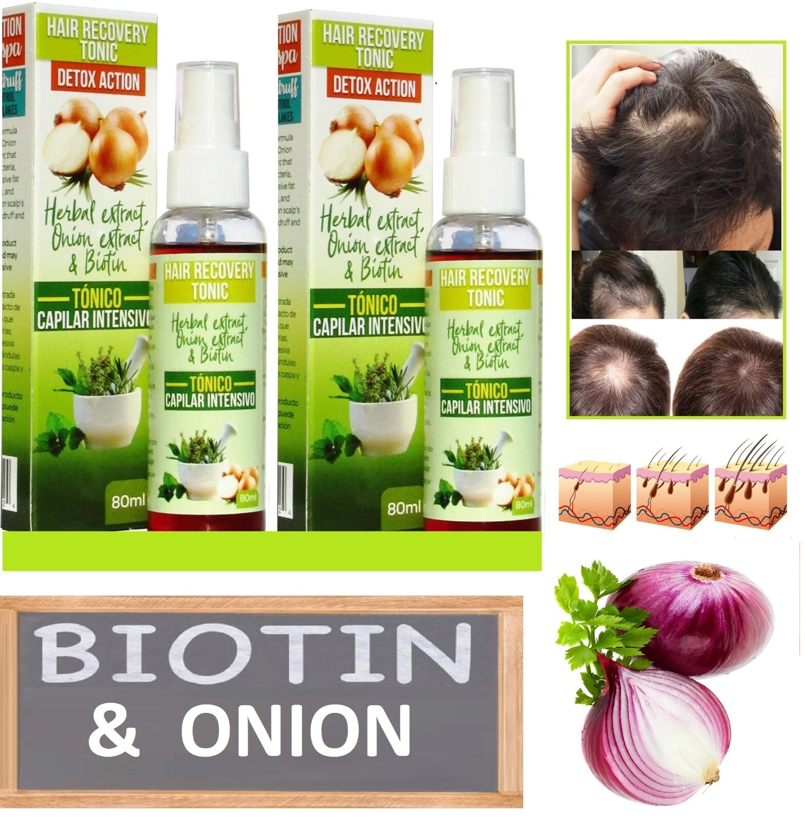 Biotin Hair Growth Serum Onion Spray 2 bottles 4oz Anti Hair Loss Regrowth Scalp