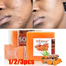 1-3X Tumeric Soap Skin Whitening Dark Spots lightening Acne Brightening Turmeric