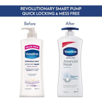 Vaseline Derma Care Advanced Repair Body Lotion|| For Sensitive|| Dry Skin|| Non