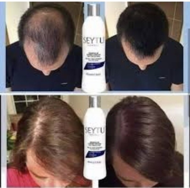 Omnilife Seytu Shampoo Cuidado Especial Caida De Cabello