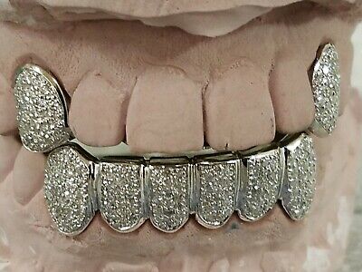 Diamond grillz