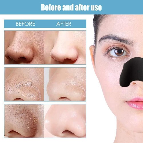 30pcs Blackhead Removal strips for Uncloging pours on nose and smoothing skin UK - Picture 12 of 17