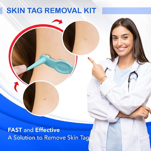 🔥TAGRID Standard Skin Tag Removal Kit 24 Bands New Sealed FAST FREE SHIPPING 🔥