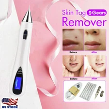Laser Plasma Pen Mole Removal Machine LCD Skin Tags Wart Dark Spots Remover Pink