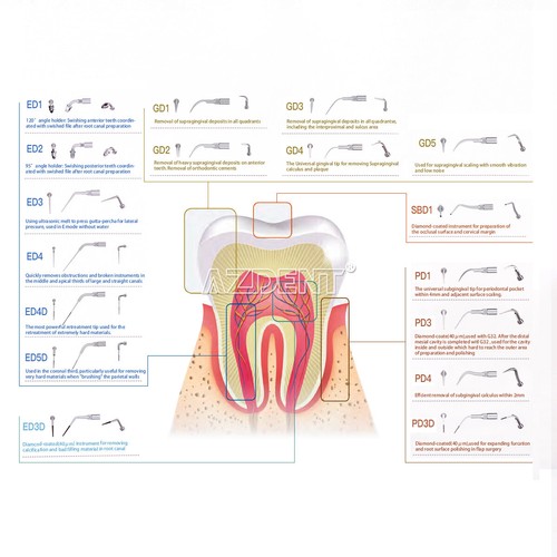 Punta escaladora ultrasónica dental endo escalado periodoncia apta para SATELEC NSK VENTA - Imagen 2 de 31