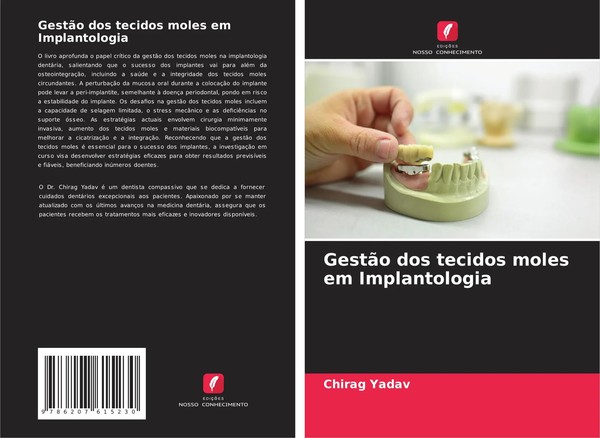 Chirag Yadav | GestãO Dos Tecidos Moles Em Implantologia | Taschenbuch (2024)-image