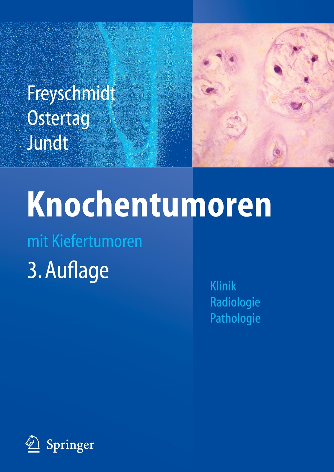 Thumbnail - Jürgen Freyschmidt (u. A.) | Knochentumoren Mit Kiefertumoren | Buch |