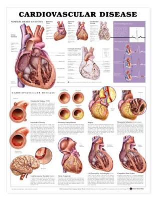 Cardiovascular Disease Wall Chart 20'' x 26'' Classroom/Professional LFA #99915