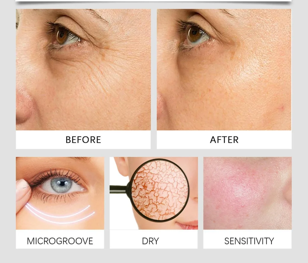 100% Natural Whipped Skin Cream for Hydration & Nourishment