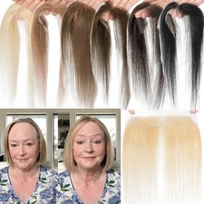 Full Lace Cover Up Women's Receding Hairline Patches 100 Remy Human Hair Topper
