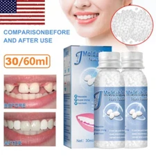 2x Resin False Teeth Solid Glue Temporary Tooth Gap Filler Tooth Repair Moldable