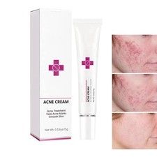 Acne Cream Pimple for Face, Oil Control 0.53 Fl Oz Pack of 1 