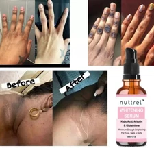 Dark Skin Whitening Dark spot Brightening Bleaching Lightening Face body Serum