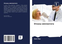 Zain Mir | Otkazy Implantata | Taschenbuch | Russisch (2024) | Sciencia Scripts