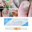 thumbnail 6 - Nail Fungal Treatment Pen Anti Fungus Infection Biological Repairs Solution Care