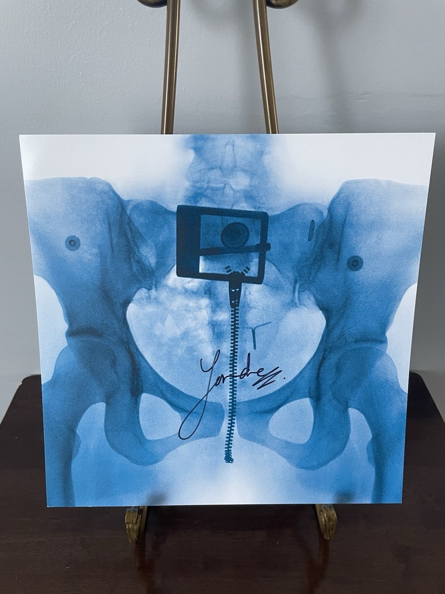新品 サイン入り Lorde / Virgin ピクチャーディスク LP AUTOGRAPHED SIGNED Lorde VIRGIN GATEFOLD Presale X-Ray