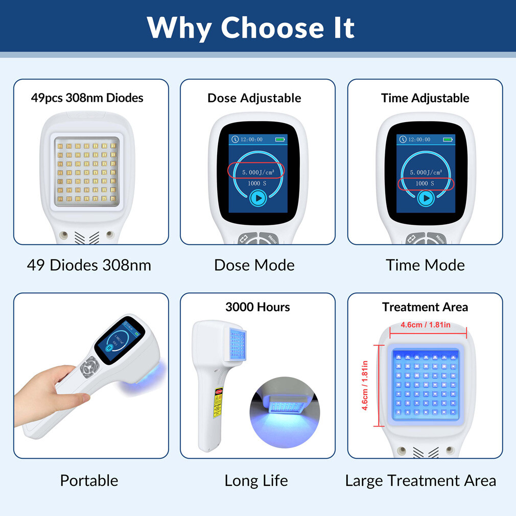 308nm Uvb Blue Light Therapy Home Use Phototherapy Device for