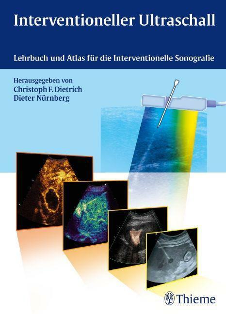Thumbnail - Interventioneller Ultraschall | Buch | 9783131311313
