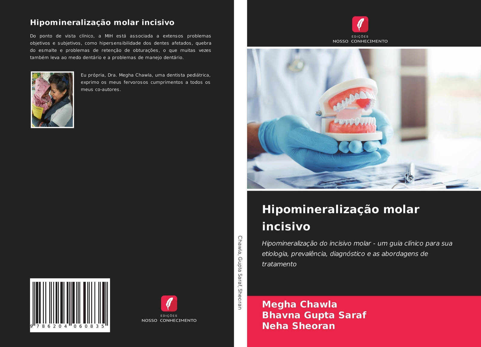 Thumbnail - Hipomineralização Molar Incisivo Megha Chawla (u. A.) Taschenbuch