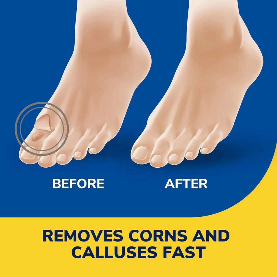Dr. Scholl's Liquid Corn & Callus Remover, 0.33 Ounce Removes Corns & Calluses.. - Image 4 of 4