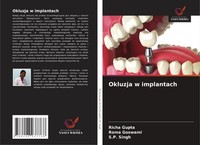 Okluzja W Implantach Richa Gupta