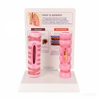 Modèle D'asthme avec Socle Pédagogique Modèle de l’asthme Bronchique Didactique - Photo 1/4