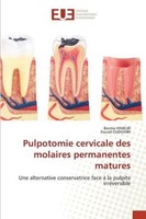 Pulpotomie Cervicale Des Molaires Permanentes Matures Besma Himeur