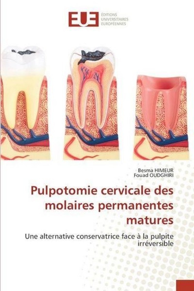 Pulpotomie Cervicale Des Molaires Permanentes Matures Besma Himeur-image