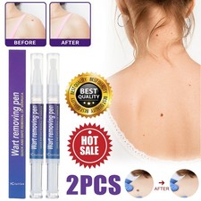 2x Wart Liquid Hand Foot Warts Remove Filiform Warts Flat Warts Pen Condyloma US