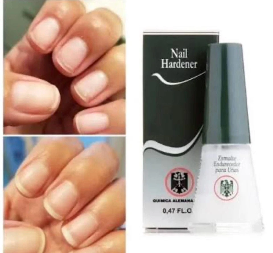 Endurecedor de uñas Quimica Alemana 0,47 fl oz Foto 4 de 4