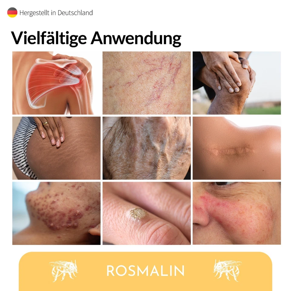 Rosmalin® Bienengift Salbe hochdosiert - Effektive Bienengift Creme - Bild 4 von 4