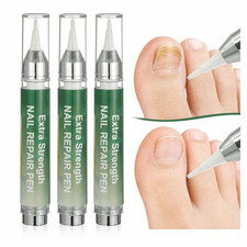 High Capacity Nail Fung-Us Pen-16 Ml per Unit,Toenail Fung-Us Pen Treatment for