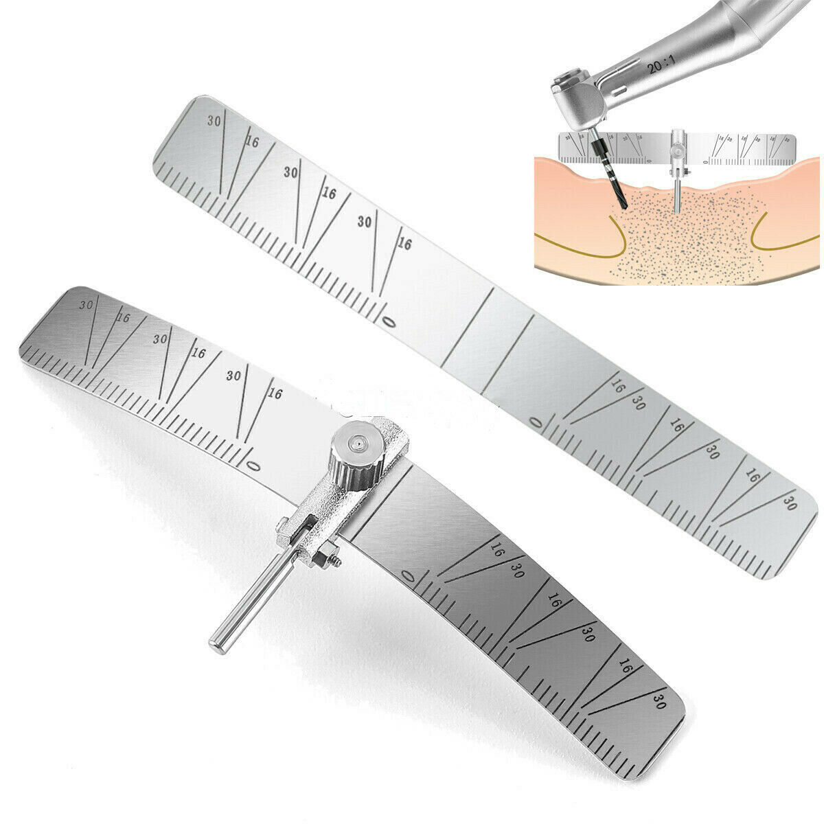 Key Surgical Screw Ruler Fundamentals Of Periodontal Instrumentation Dental Implant Locating ...