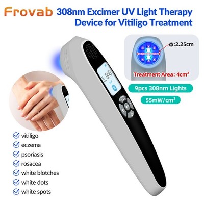 308nm Excimer UVB Light for Skin Conditions Handheld Phototherapy Device 9Diodes