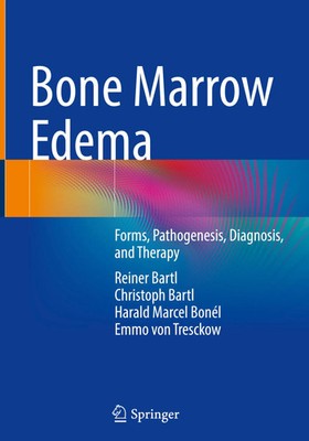 Bone Marrow Edema | Forms, Pathogenesis, Diagnosis, and Therapy | Bartl (u. a.)