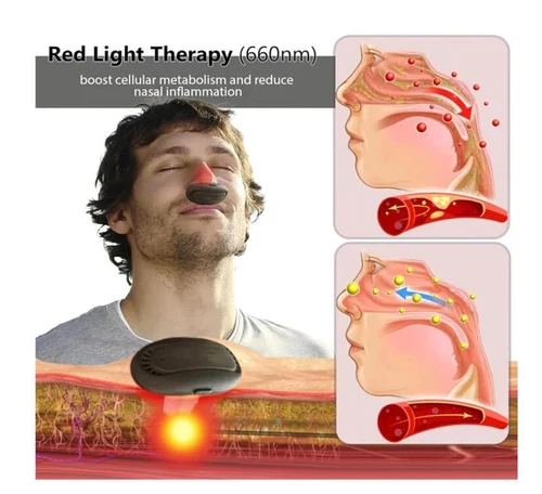 Relief Rotlicht Nasaltherapiegerät Physiotherapie-Nasenberuhigungsgerät für Nase - Bild 4 von 8